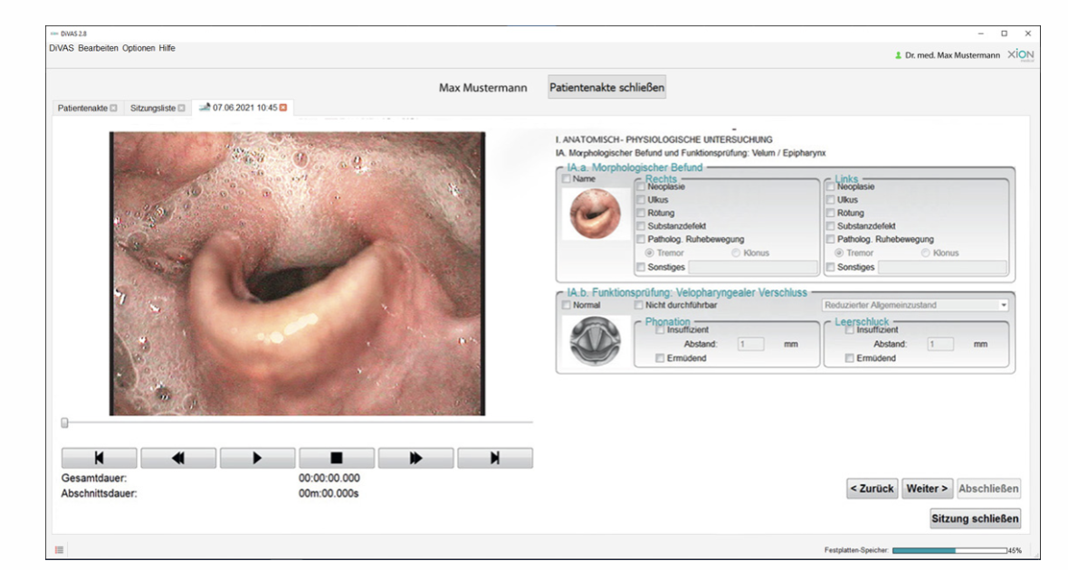 Dysphagia (FEED) — DiVAS module