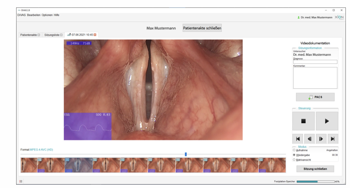 Phoniatrics — DiVAS module