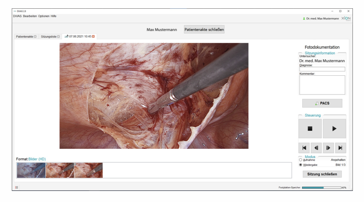 Picture / Video Documentation — DiVAS module