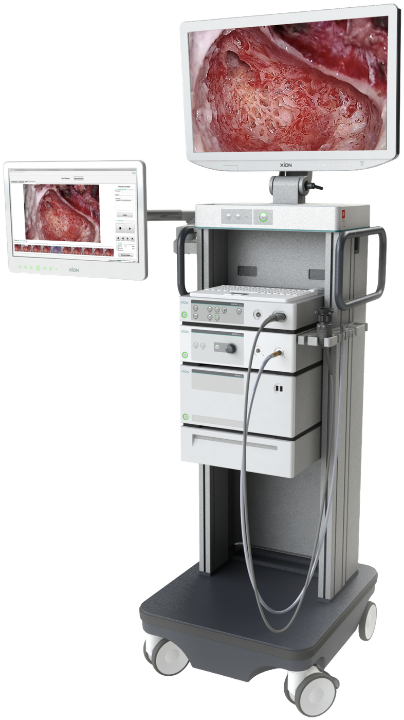 EndoSURGERY Spectar