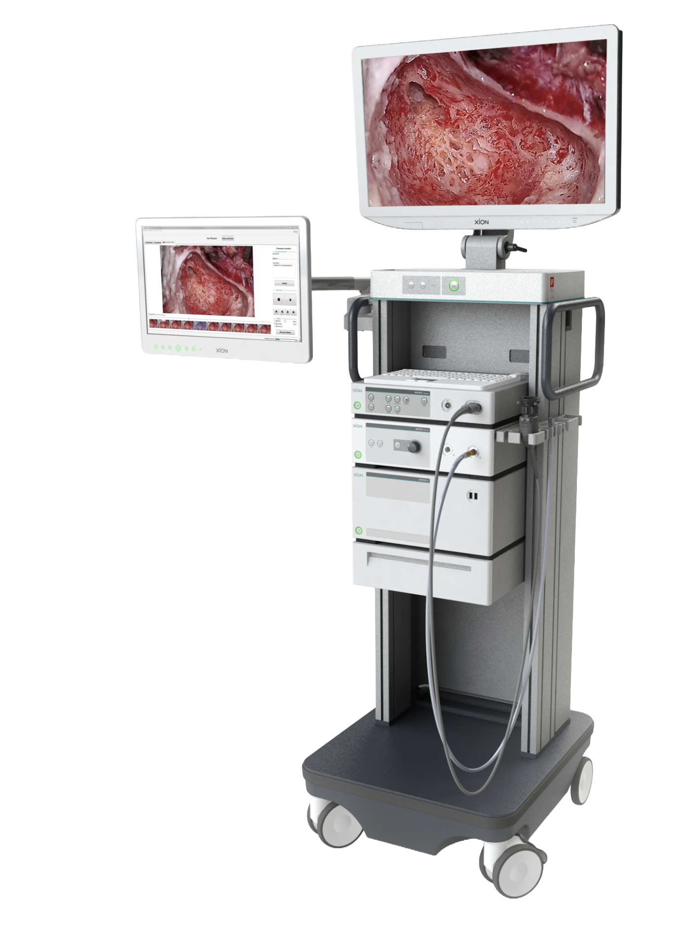XION Urology